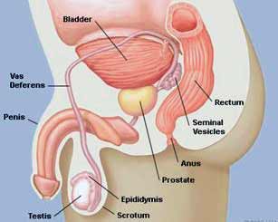 unilateral prostate enlargement)